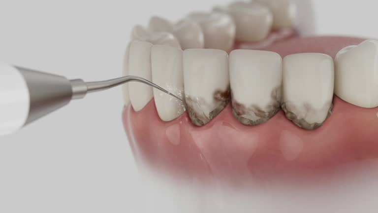 Reliable Dental Implants contractor in Georgetown, CO by Smile Center Dentistry